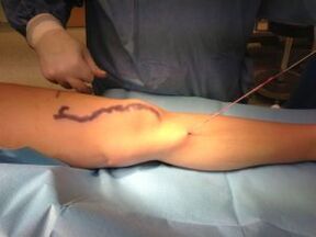 Operation